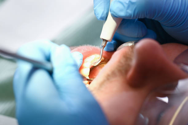 Best Broken or Chipped Tooth Repair in Weddington, NC