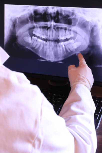 Best Emergency Treatment for Oral Infections in Weddington, NC